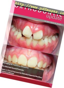 Orthodontic Update – July 2017