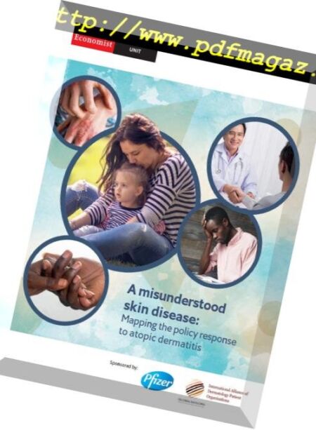 The Economist (Intelligence Unit) – A misunderstood skin disease Mapping the policy response to atopic dermatitis 2018 Cover