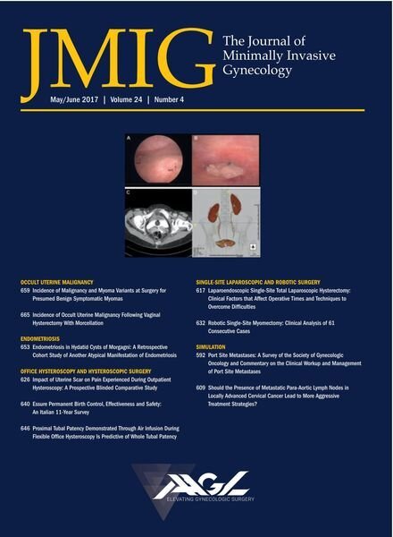 JMIG Journal of Minimally Invasive Gynecology – May 2017 Cover